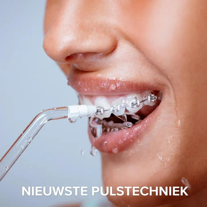 Norexo nieuwste draadloze waterflosser